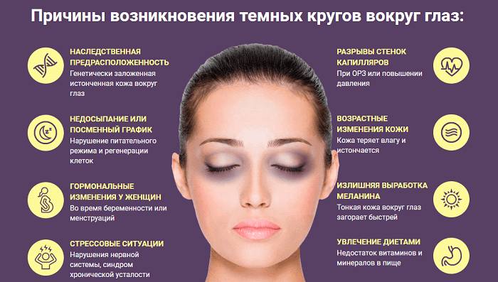Темные круги