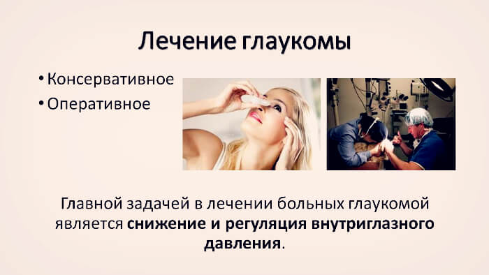Терапия глаукомы