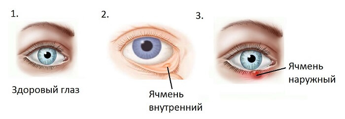 Типология ячменя у человека