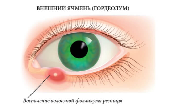 Внешний ячмень