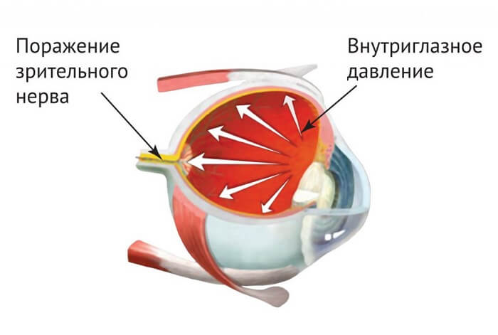 Внутриглазное давление