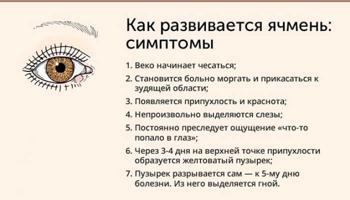 Ячмень на глазах